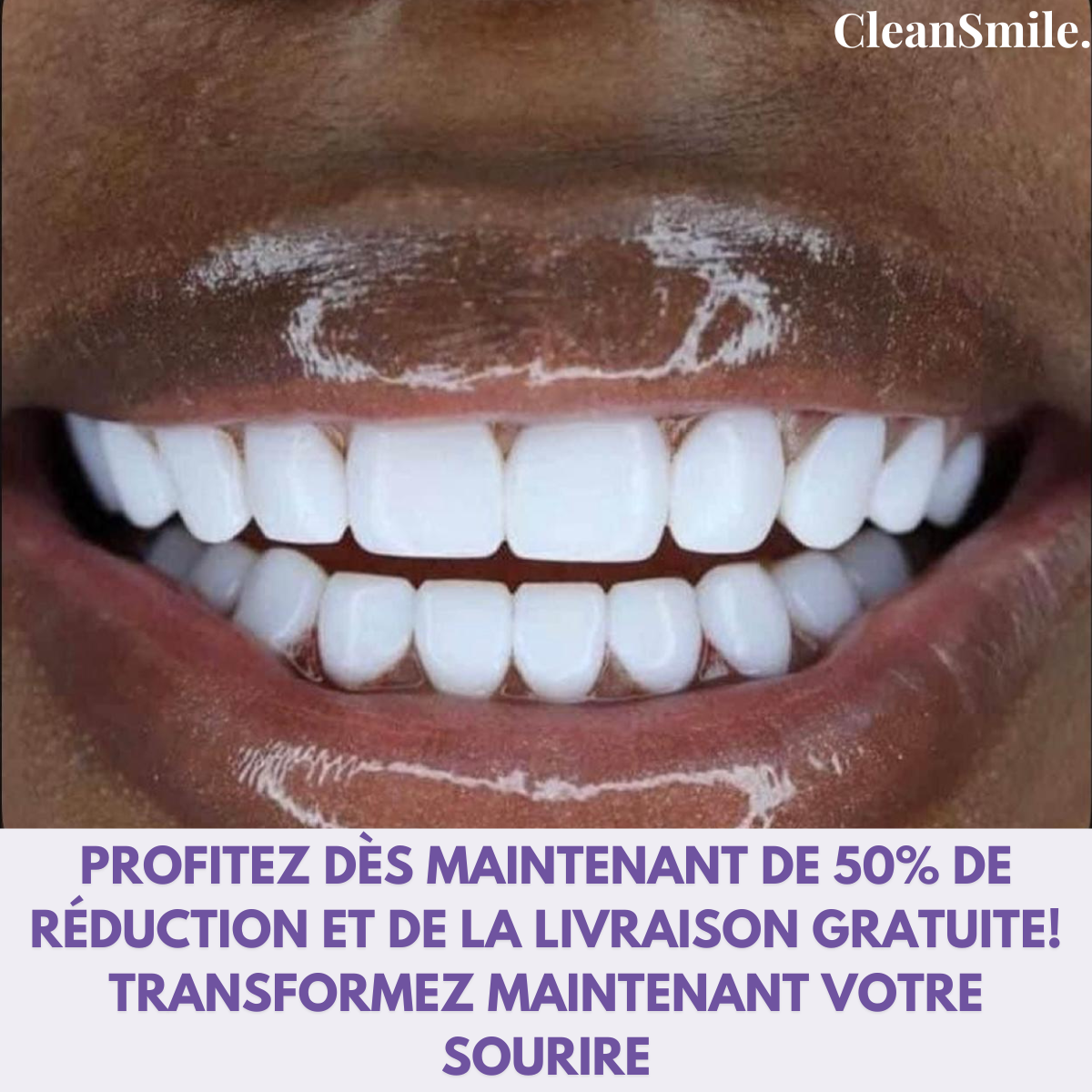 Sérum Blanchissant V34- Souriez en toute confiance