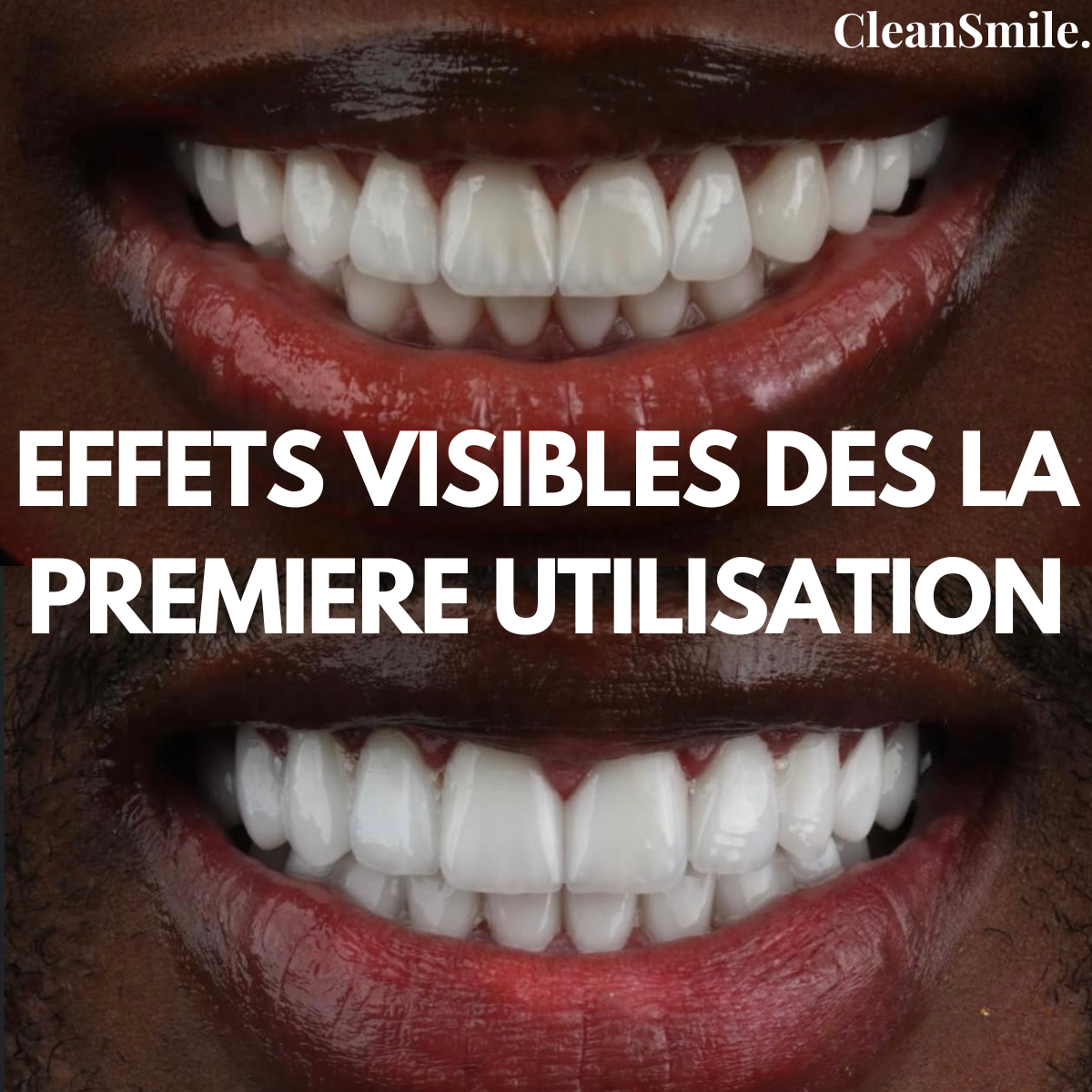 Sérum Blanchissant V34- Souriez en toute confiance