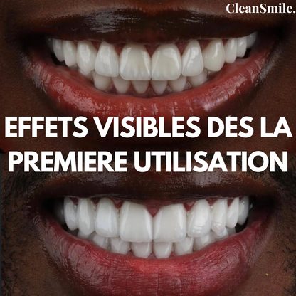 Sérum Blanchissant V34- Souriez en toute confiance